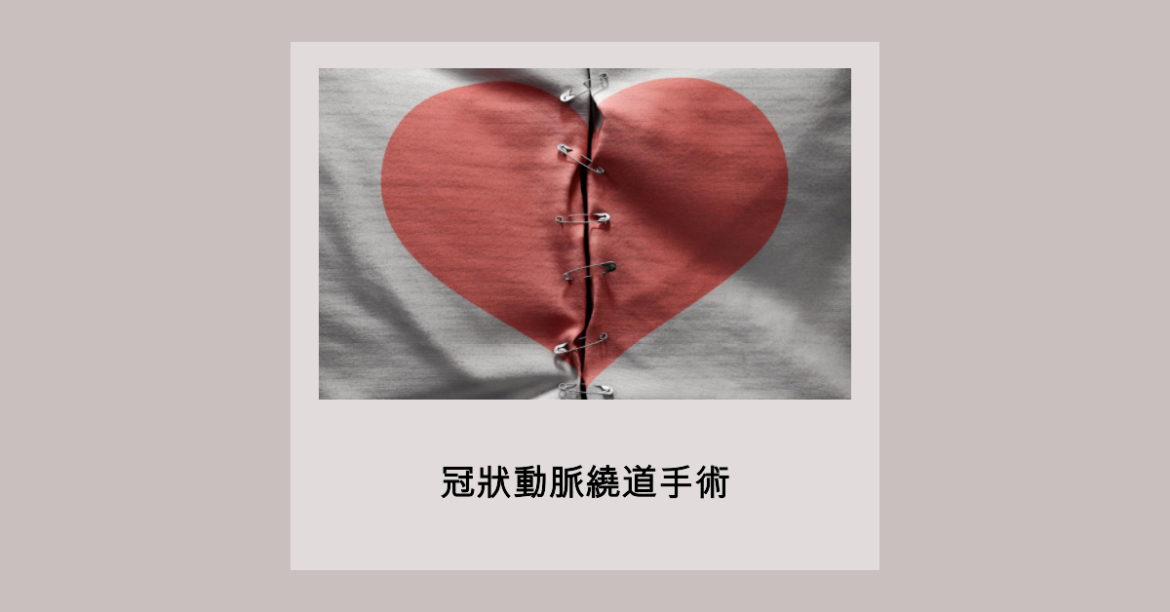 冠狀動脈繞道手術